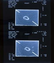 52/01.01 Ohne Titel (Phar Lap's Heart), 1990
