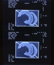 52/01.13 Ohne Titel (Phar Lap's Heart), 1990