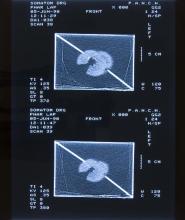 52/01.18 Ohne Titel (Phar Lap's Heart), 1990
