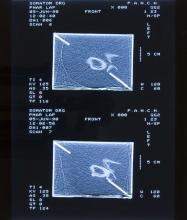 52/01.02 Ohne Titel (Phar Lap's Heart), 1990