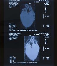 52/01.22 Ohne Titel (Phar Lap's Heart), 1990