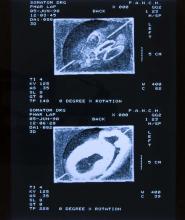 52/01.23 Ohne Titel (Phar Lap's Heart), 1990