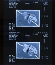 52/01.05 Ohne Titel (Phar Lap's Heart), 1990
