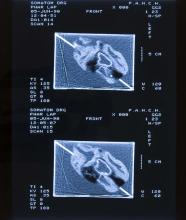 52/01.06 Ohne Titel (Phar Lap's Heart), 1990