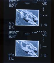 52/01.07 Ohne Titel (Phar Lap's Heart), 1990