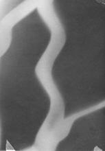 30/01.15 Ohne Titel, 1983